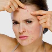 adult womens acne treatment
